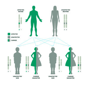 This diagram shows how Duchenne Muscular Dystrophy  can be passed down in a family when the father is affected and the mother is unaffected and not a carrier. It explains the chances of having children who are unaffected, carriers, or affected.