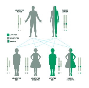 This diagram shows how Duchenne Muscular Dystrophy  can be passed down in a family when the father is not affected and the mother is a carrier. It explains the chances of having children who are unaffected, carriers, or affected.