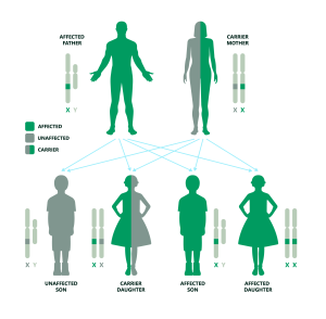 This diagram shows how Duchenne Muscular Dystrophy  can be passed down in a family when the father is affected and the mother is a carrier. It explains the chances of having children who are unaffected, carriers, or affected.